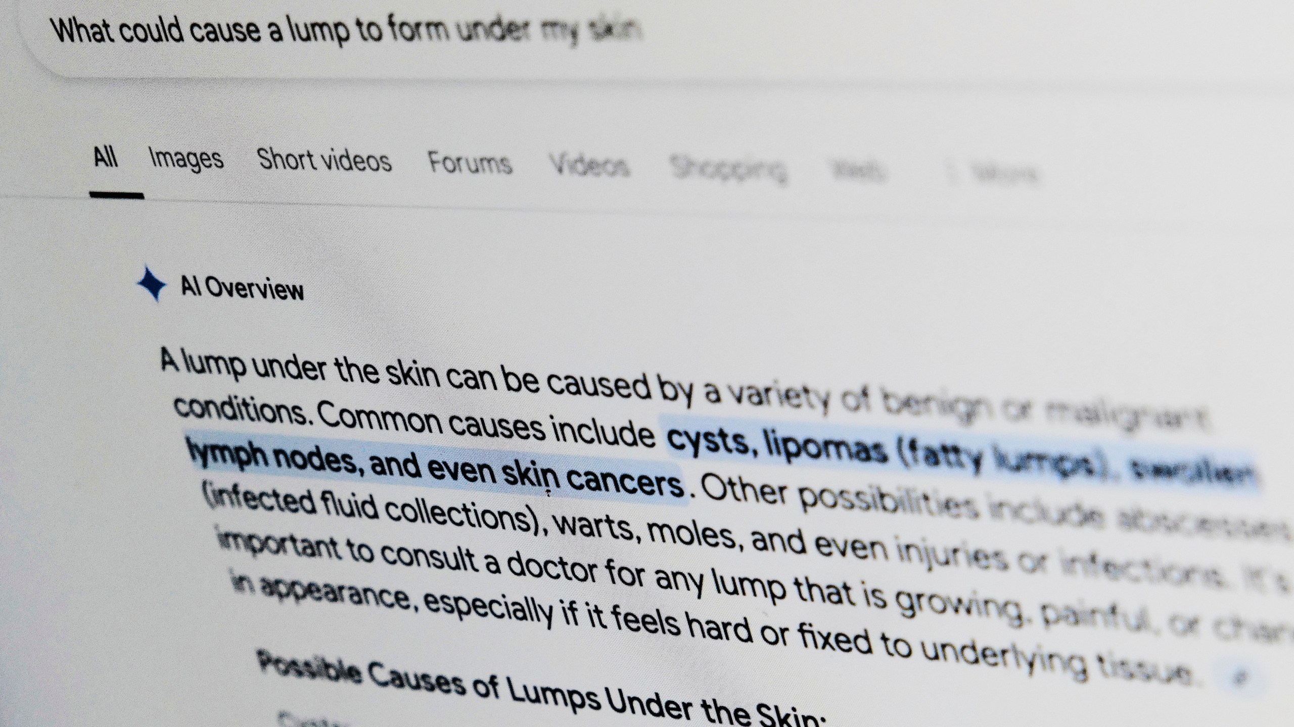 A health-related query on Google is displayed on a computer screen in New York on Thursday, April 24, 2025. (AP Photo/Patrick Sison)