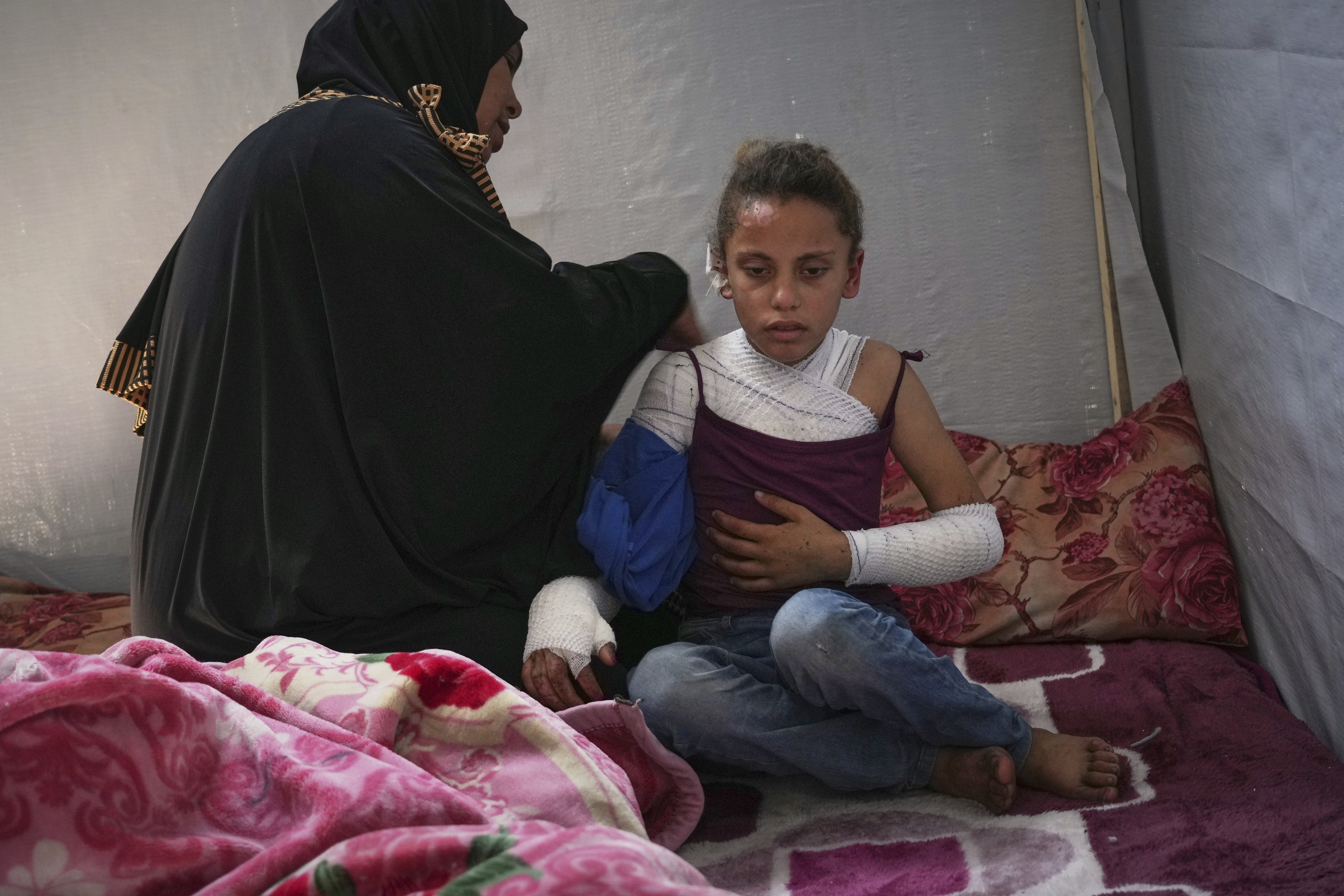 Haneen al-Khazandar cares for her 10-year-old daughter Mira who was severely burned on her arms and chest when an Israeli army strike hit near her tent, in Khan Younis, Gaza Strip, Sunday, May 4, 2025.(AP Photo/Abdel Kareem Hana)