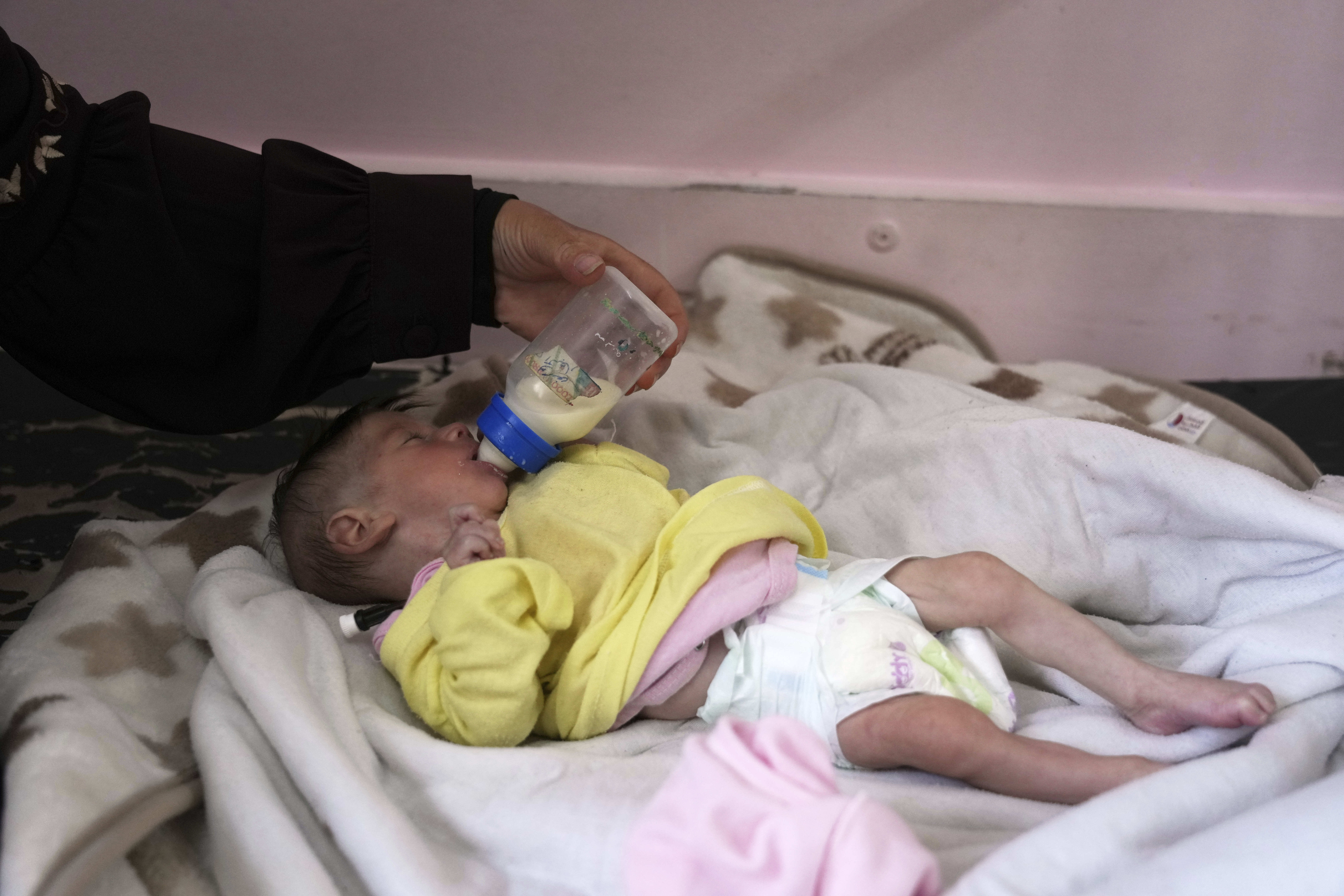Najia Al-Najjar feeds her 5-month-old baby, Yousef, who suffers from malnutrition, at a clinic in Nasser hospital, Khan Younis, Gaza, Wednesday, May 21, 2025. (AP Photo/Abdel Kareem Hana)