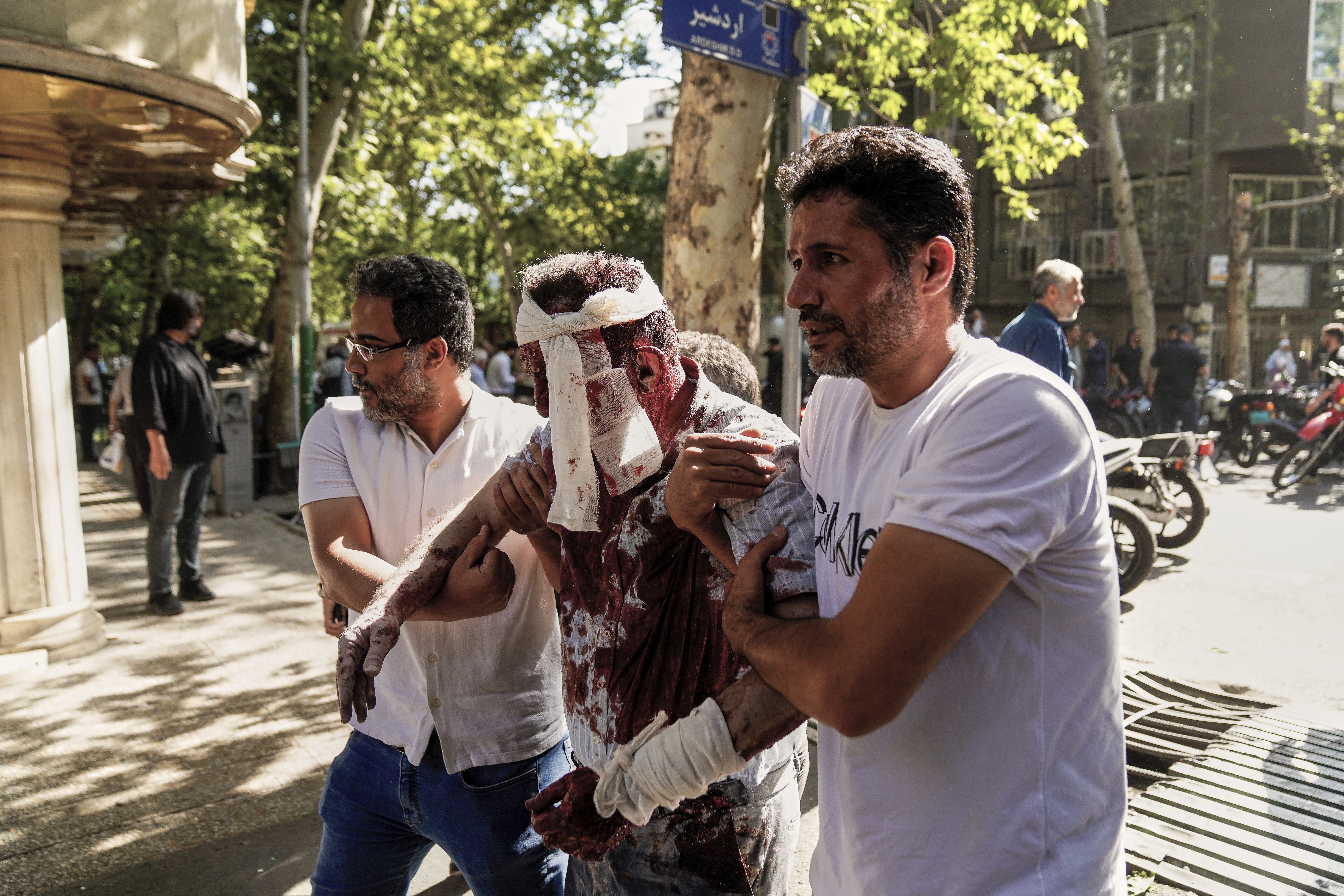 An injured man is helped to leave the scene after an explosion in downtown Tehran, amid Israel's three-day campaign of strikes against Iran, Sunday, June 15, 2025. (AP Photo/Amir Kholousi/ISNA)