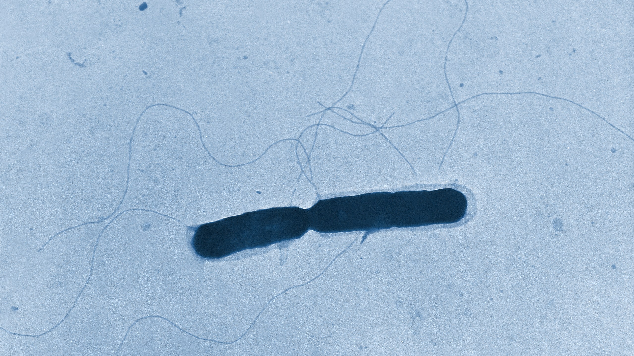 This 1966 transmission electron microscope image provided by the Centers for Disease Control and Prevention shows a Listeria bacterium with its flagella, in the process of cell division. (Graham Heid/CDC via AP)