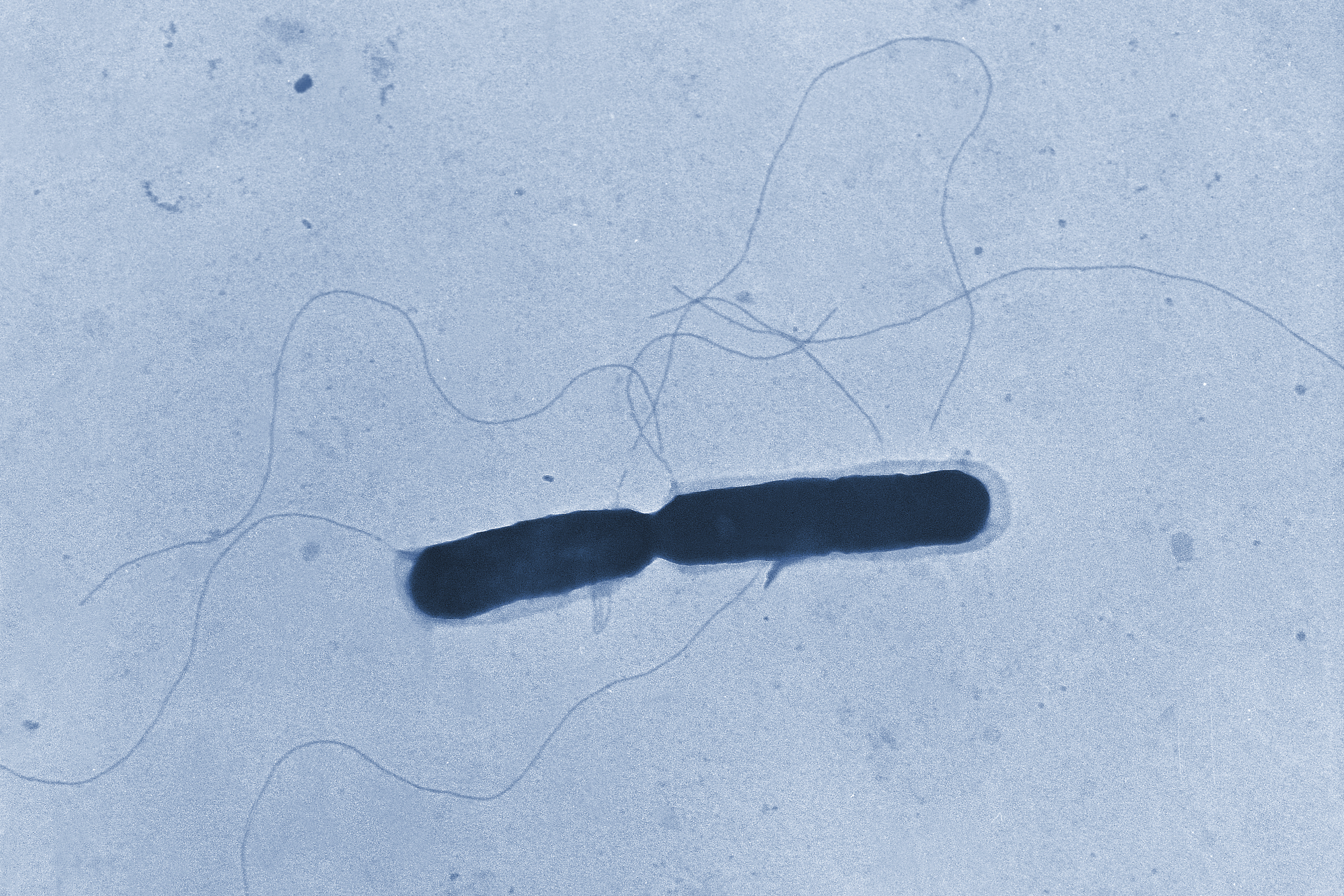 This 1966 transmission electron microscope image provided by the Centers for Disease Control and Prevention shows a Listeria bacterium with its flagella, in the process of cell division. (Graham Heid/CDC via AP)