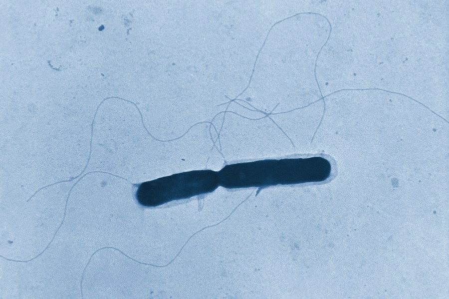 This 1966 transmission electron microscope image provided by the Centers for Disease Control and Prevention shows a Listeria bacterium with its flagella, in the process of cell division. (Graham Heid/CDC via AP)