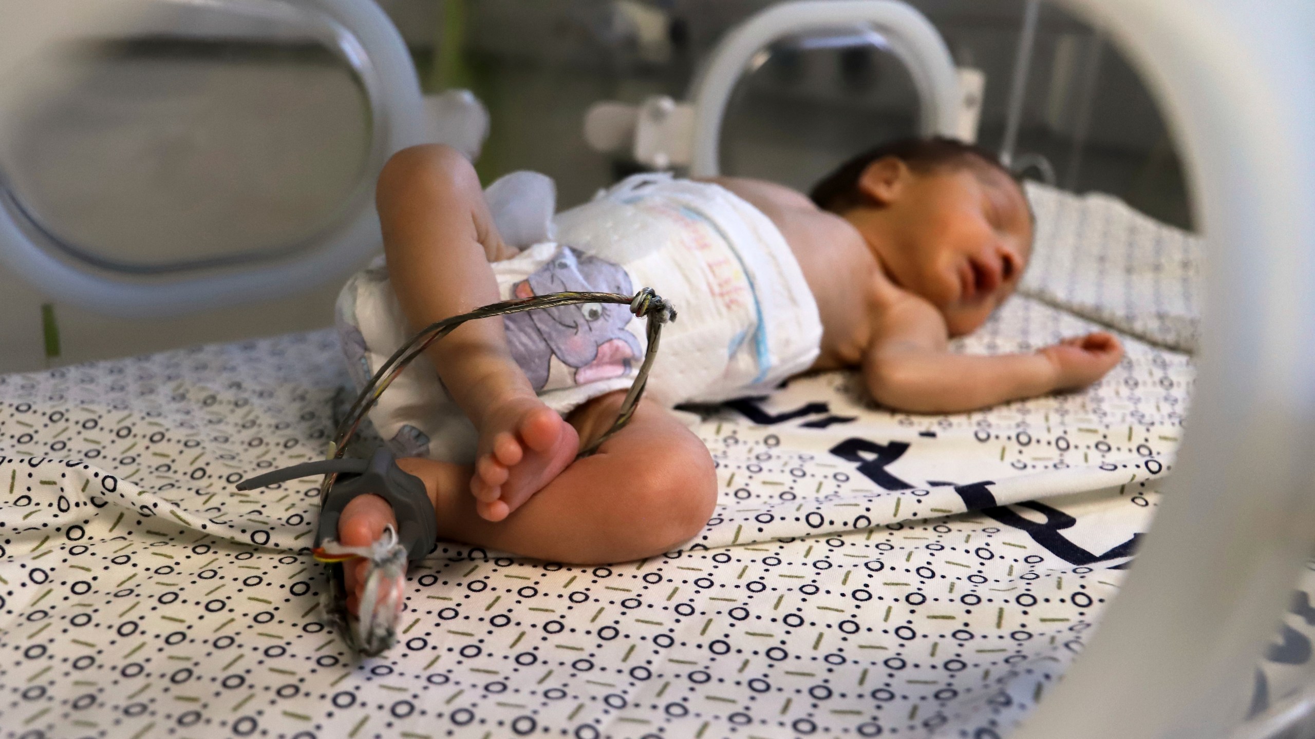 A prematurely born baby lies in an incubator at the neonatal intensive care unit of Nasser Hospital in Khan Younis, southern Gaza Strip, Thursday, June 19, 2025. (AP Photo/Mariam Dagga)