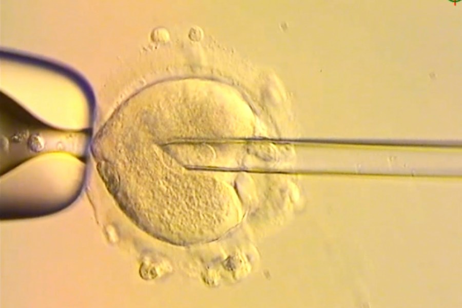 This image from video provided by the Newcastle Fertility Centre shows a nuclear genome from an egg carrying a mitochondrial DNA mutation being inserted into an egg donated by an unaffected woman. (Newcastle Fertility Centre, Newcastle Hospitals NHS Foundation Trust via AP)