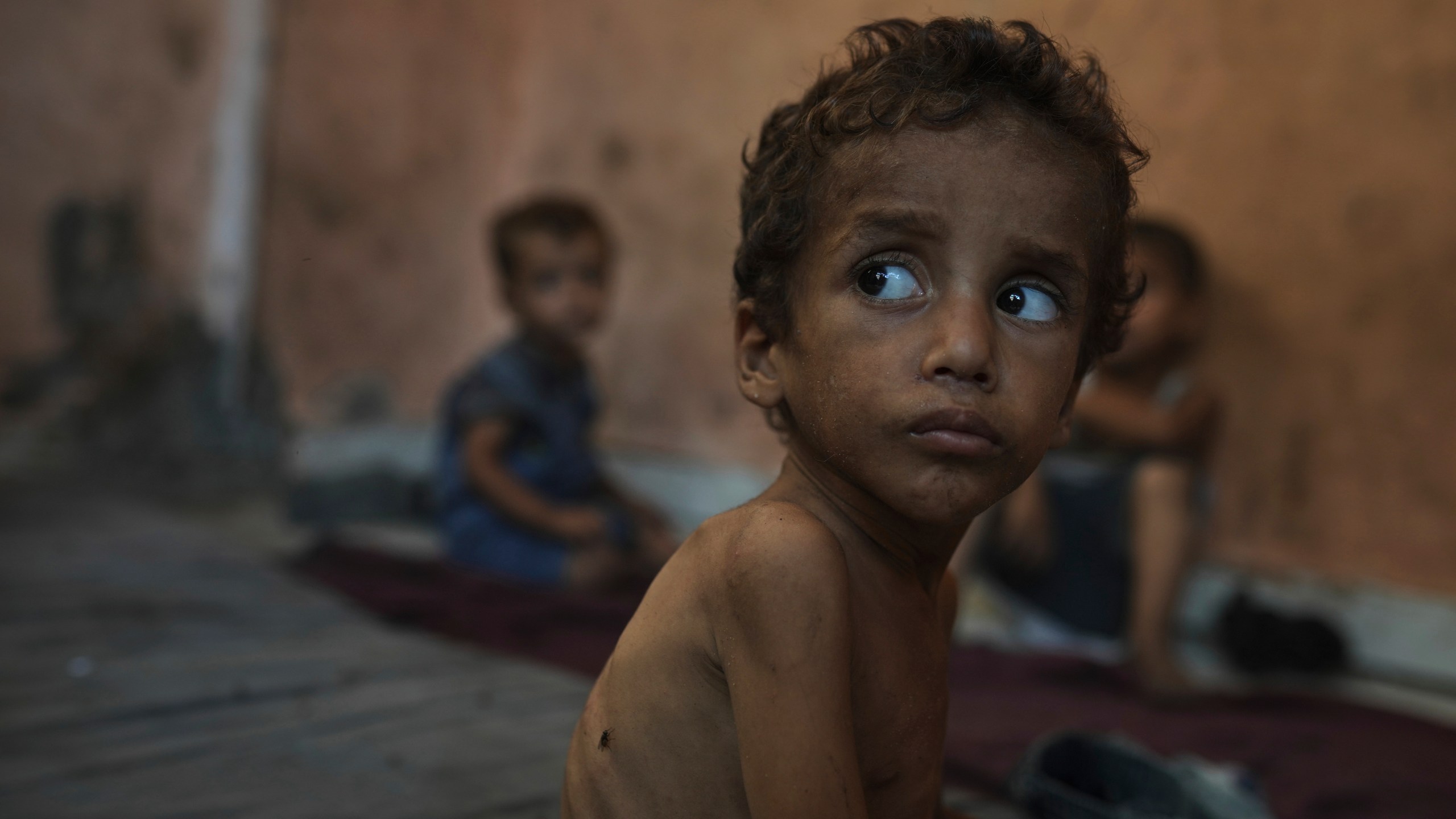 Yazan Abu Ful, a 2-year-old malnourished child, sits at his family home in the Shati refugee camp in Gaza City on Wednesday, July 23, 2025. (AP Photo/Jehad Alshrafi)