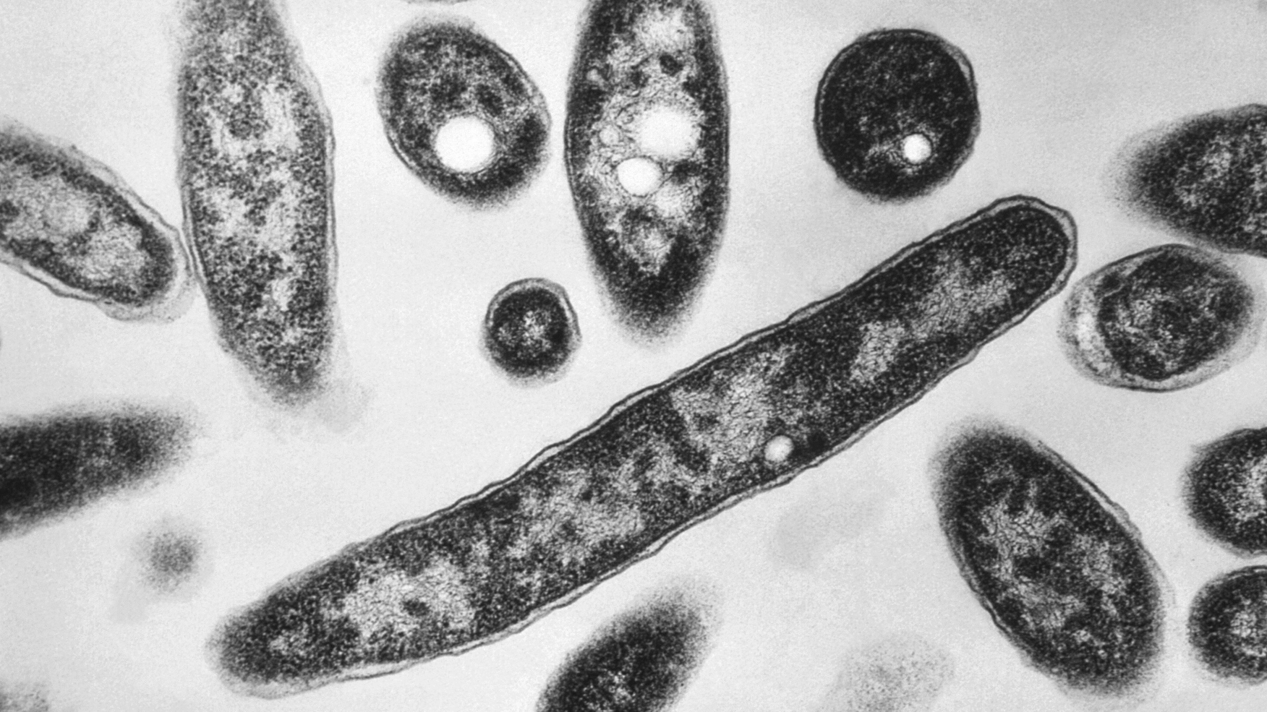 FILE - This 1978 electron microscope image made available by the Centers for Disease Control and Prevention shows Legionella pneumophila bacteria which are responsible for causing the pneumonic disease Legionnaires' disease. (Francis Chandler/CDC via AP, File)