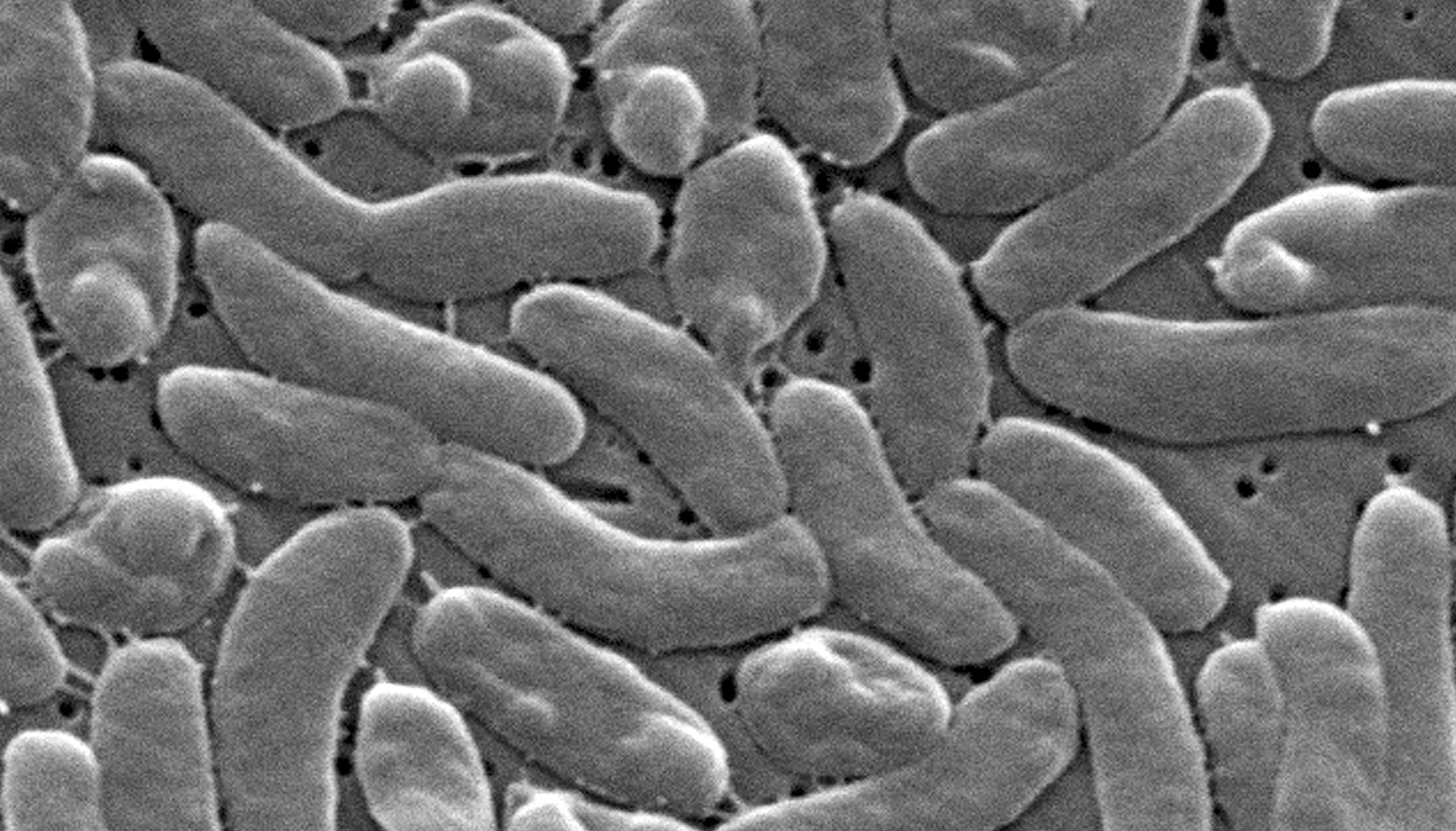 This electron microscope image provided by the Centers for Disease Control and Prevention shows Vibrio vulnificus bacteria in 2005. (Janice Haney Carr/CDC via AP)
