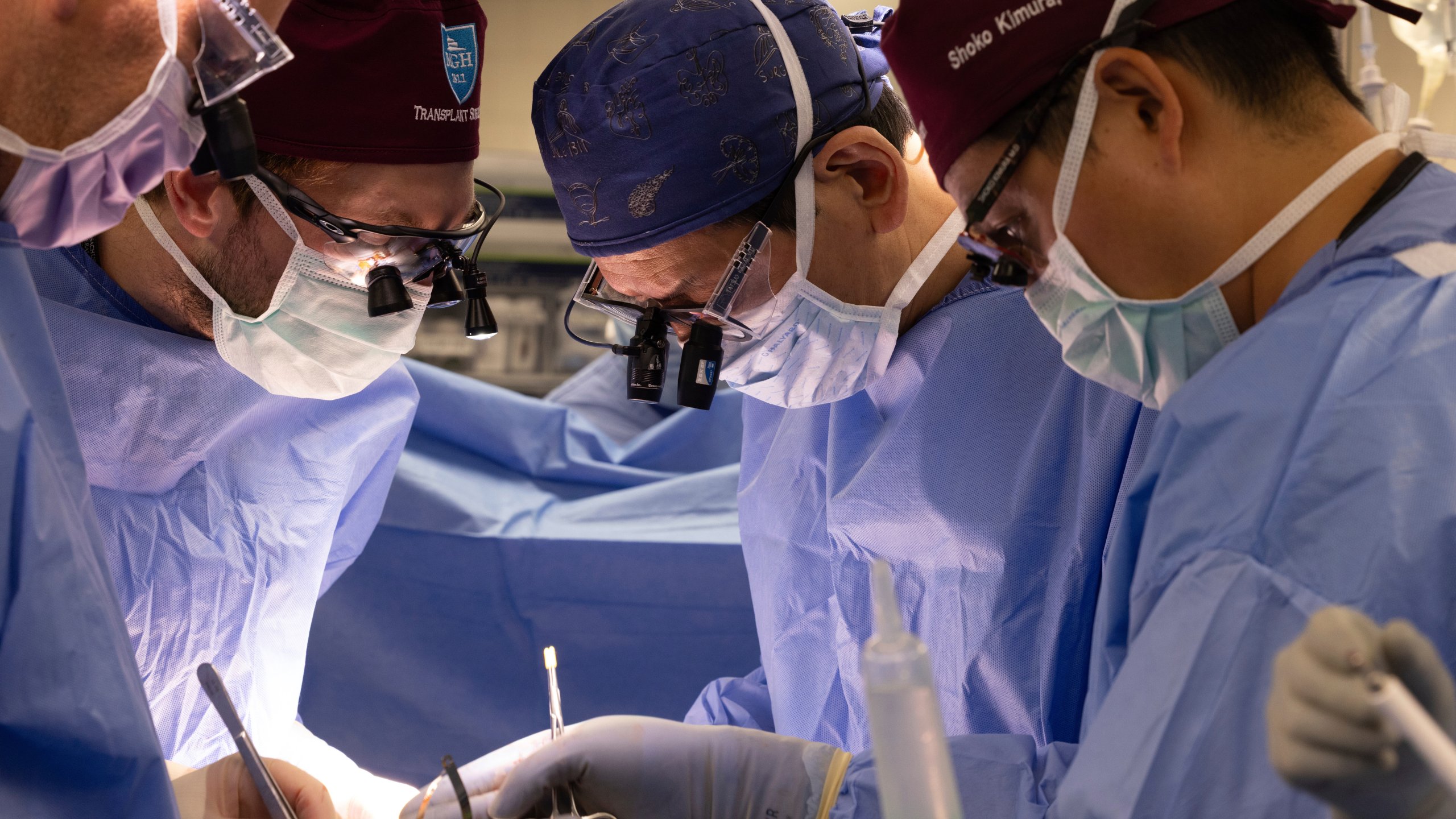 In this photo provided by Mass General Brigham, from left, surgeons Dr. Nahel Elias, Dr. Alban Longchamp, Dr. Tatsuo Kawai and Dr. Shoko Kimura transplant a genetically edited pig kidney into Bill Stewart June 14, 2025 at Massachusetts General Hospital in Boston. (Sarah Evans/Mass General Brigham via AP)
