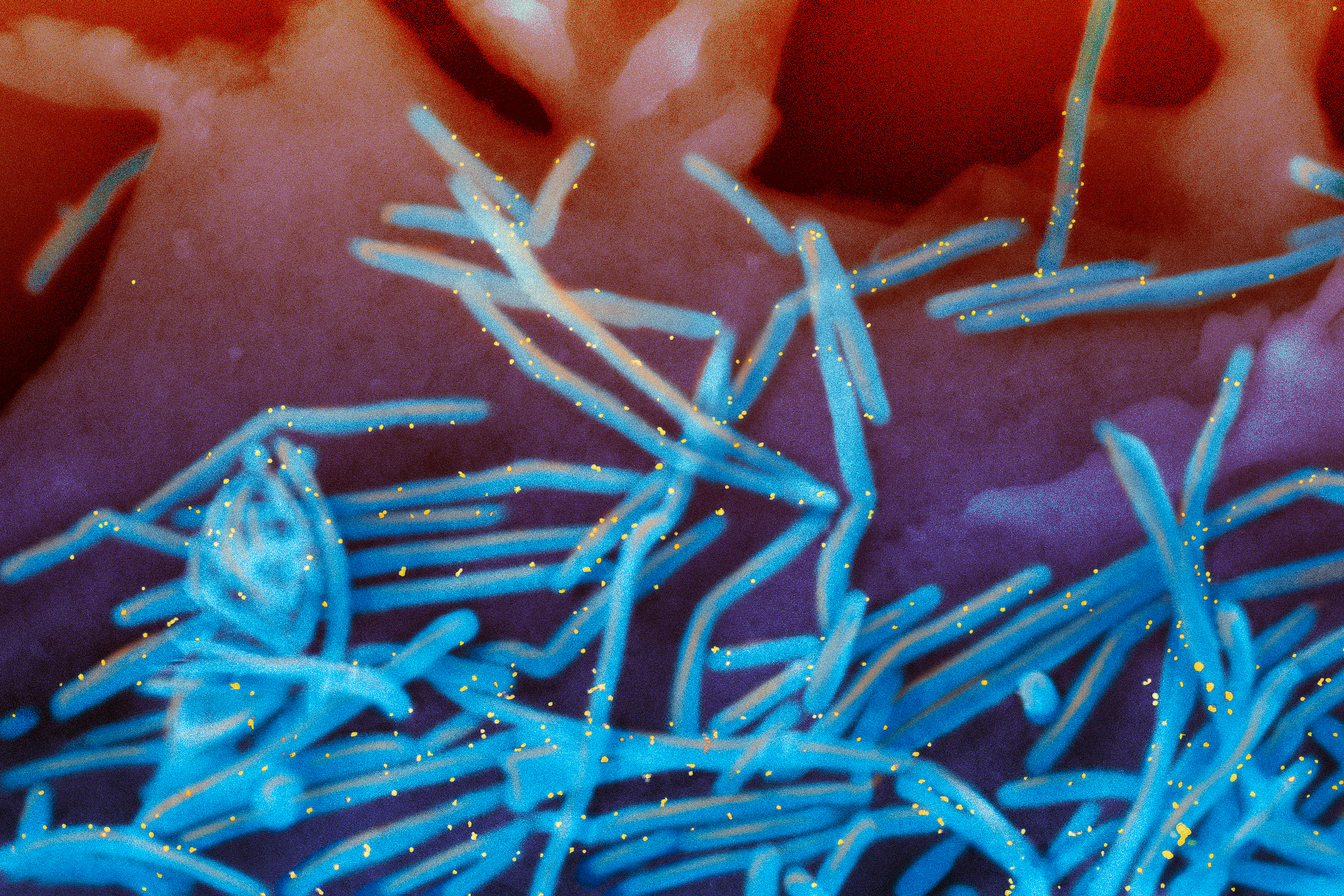 FILE - This electron microscope image provided by the National Institutes of Health shows human respiratory syncytial virus (RSV) virions, colorized blue, and anti-RSV F protein/gold antibodies, colorized yellow, shedding from the surface of human lung cells. (National Institute of Allergy and Infectious Diseases, NIH via AP, File)